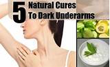 Images of Underarm Dark Patches Home Remedies