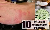 Best Home Remedies For Poison Ivy Pictures