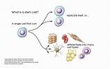 Images of Stem Cell Transfer