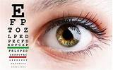 Eye Exercises For Myopia Images