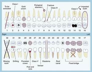 Dental Charting Symbols World Of Template Format Throughout Dental
