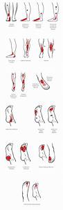 Trigger Point Referral Patterns For The Ankle Foot Anatomy My