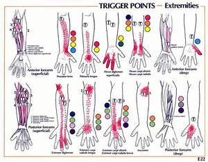 Image Result For Forearm Trigger Points Carpal Tunnel Neuromuscular
