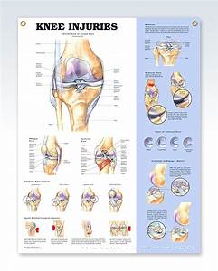 Knee Injuries Exam Room Human Anatomy Poster Clinicalposters