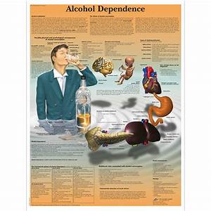 Alcohol Abuse Chart Alcohol Abuse Poster Health Education Charts