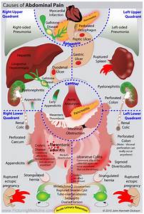 Abdominal Symptoms Causes
