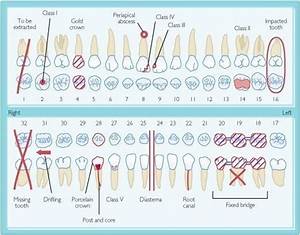 Dental Charting Form Dental Humor Pinterest Dental Dental For