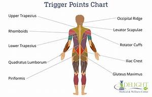 Trigger Points And Referral Delight Medical And Wellness Center