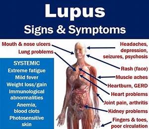 Lupus Signs And Symptoms With Full Description Of Features