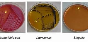 Salmonella Shigella Ss Agar Composition Principle Procedure And