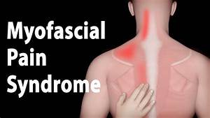 Myofascial Syndrome And Trigger Points Treatments Animation