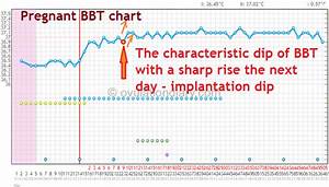 Bbt Chart Examples