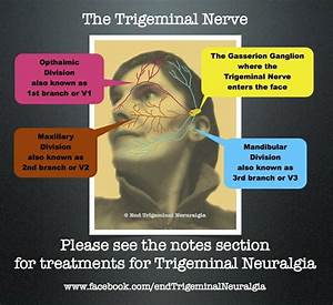 1000 Images About End Trigeminal Neuralgia On Pinterest Who Am I A