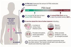Guidance Updated On Psa Testing For Cancer Phe Screening