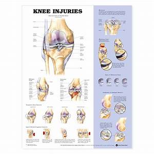 The Knee Injuries Anatomical Charts 20 39 39 X 26 39 39
