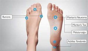 Foot Introduction Causes And Treatment