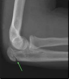 Differential Diagnosis Elbow And Forearm