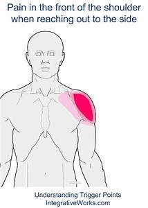 Trigger Points In Front Of Shoulder When Reaching Out To The