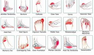 Foot Injuries Pacific Coast Chiro Wellness
