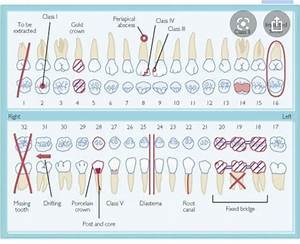 Pin By Shey Valentin On Dental Dental Charting Dental Hygiene School