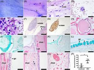 Cytological And Microbiological Characteristics Of Middle Ear Effusions