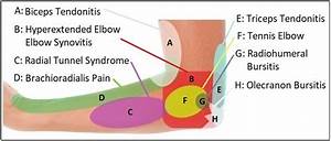 Elbow Diagram Diagnosis Chart