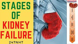 5 Stages Of Kidney Failure What Are The 5 Stages Of Kidney Failure