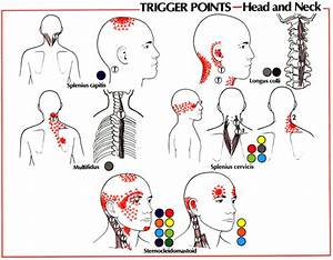  Relief Relief Therapy Trigger Points Head And Neck