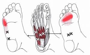 Abductor Digiti Minimi Foot The Trigger Point Referred Guide