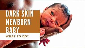 Help My Newborn Baby Skin Color Has Become Dark Why What To Do