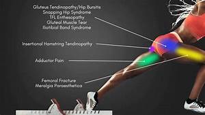 hip location diagram hip location chart