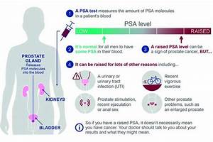 Guidance Updated On Psa Testing For Cancer Phe Screening