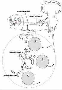 Referred Dental It Hurts But Where And Why There