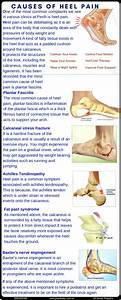 Causes Of Heel 