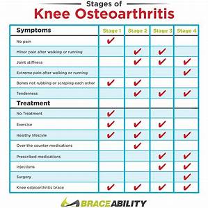 4 Stages Of Knee Osteoarthritis Arthritis Joint Treatment