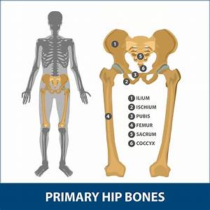 Hip Dislocation Information Florida Orthopaedic Institute