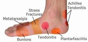 Pin On Reflexology Foot Chart