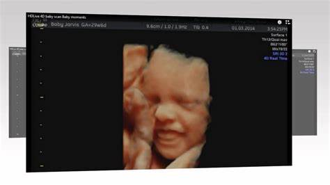4d scan alvechurch