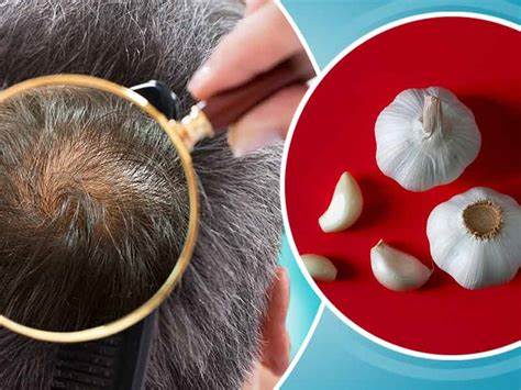 Step by step instructions to Use Garlic For Hair Growth