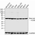 HeLa Cell Fractionatio… 