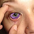 Top 10 Eye Diseases
