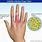 Cellulitis Finger Infection