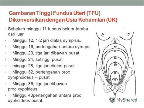 tinggi fundus uteri pada ibu hamil trisemester 3