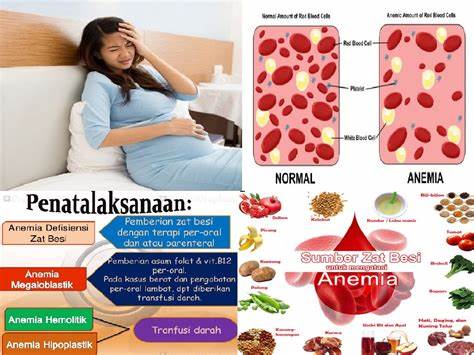 Mencegah anemia