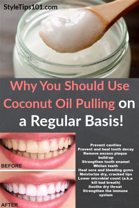 Oil Pulling with Coconut Oil