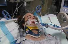 kailynn panchuk injuries injured teenager cbc saskatoon receives