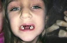 teeth dentist child abuse took pulling children reason accused tooth nightmare abusing girl if dental sued far friday charged florida