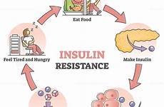 insulin pathological vectormine