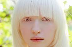 albino albinism albinos models augen mensch albinas chubb nastya farm9 pessoas gesicht charakter olhos personas estrela ruby humans schönheit shown