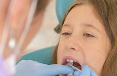 tanden examining checked meisje tandarts hebben tand